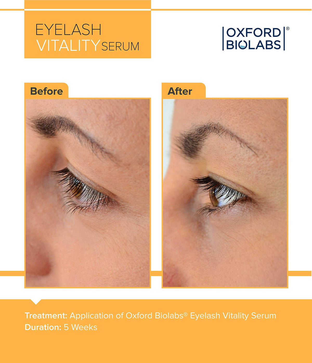 Eyelash Enhancing Serum - Effective Lash & Brow Growth Serum Complex by Oxford Biolabs