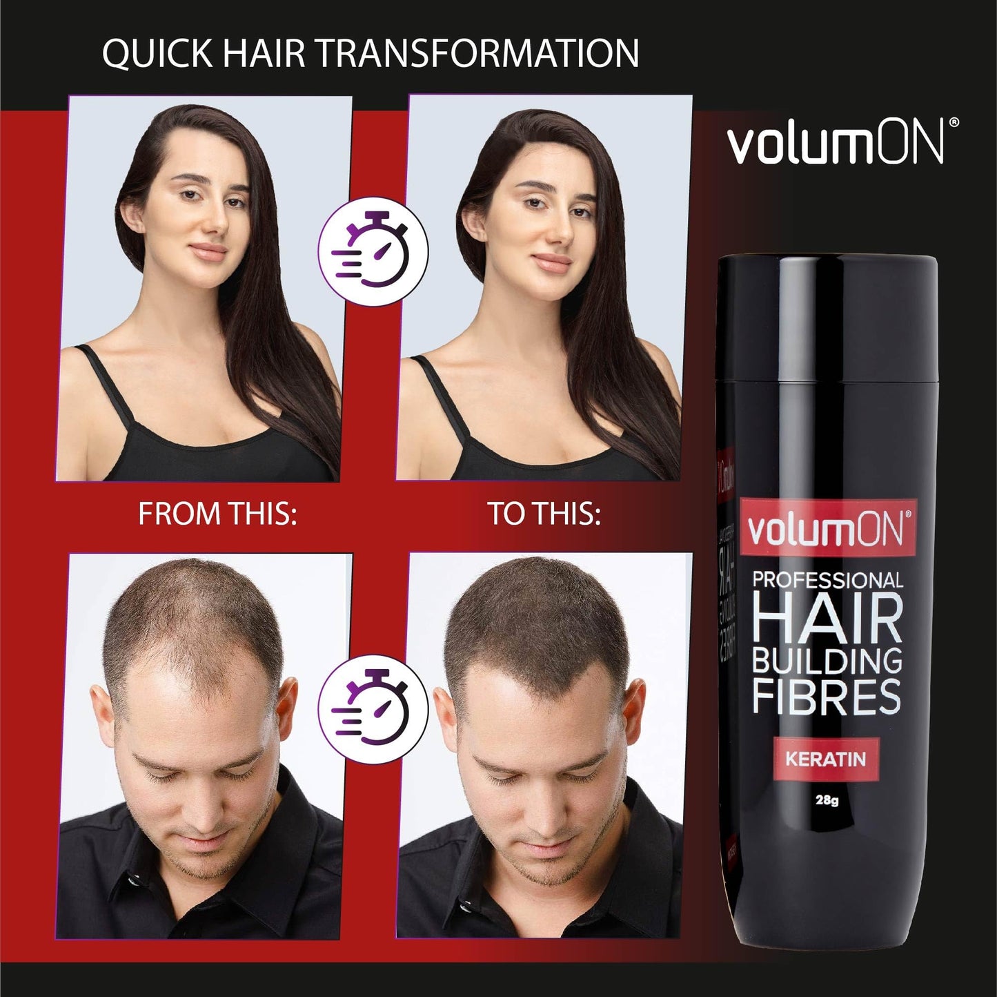 Volumon Professional Hair Building Fibres- Hair Loss Concealer- KERATIN- BLACK 28g- Get Upto 30 Uses