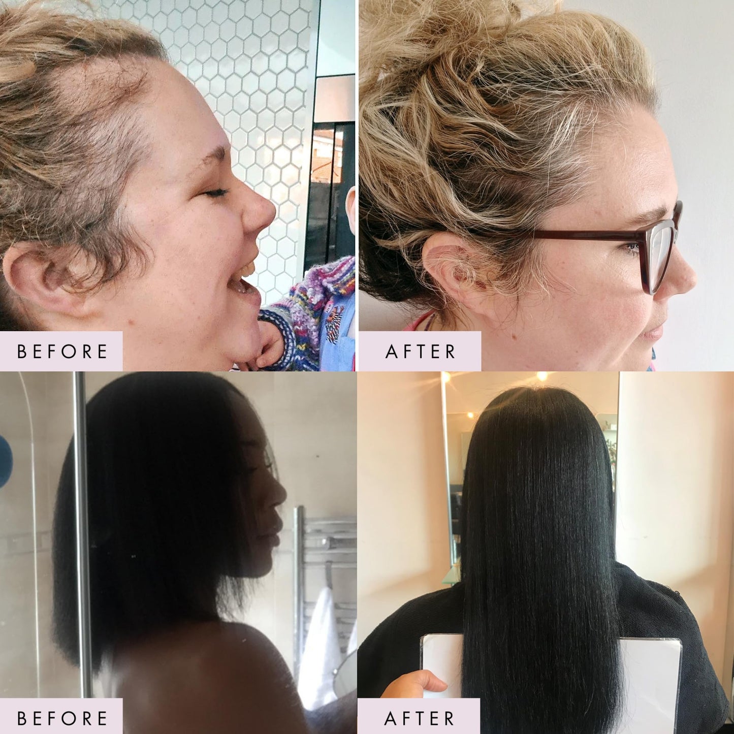 Grow by Hair Gain Biotin Hair Growth Supplement - Supports Hair Growth, Enhanced Hair Vitamins Complex, Grow Fuller Thicker Hair, Hair Skin & Nails Vitamins for Women, Vegan Capsules - 1 Month Supply