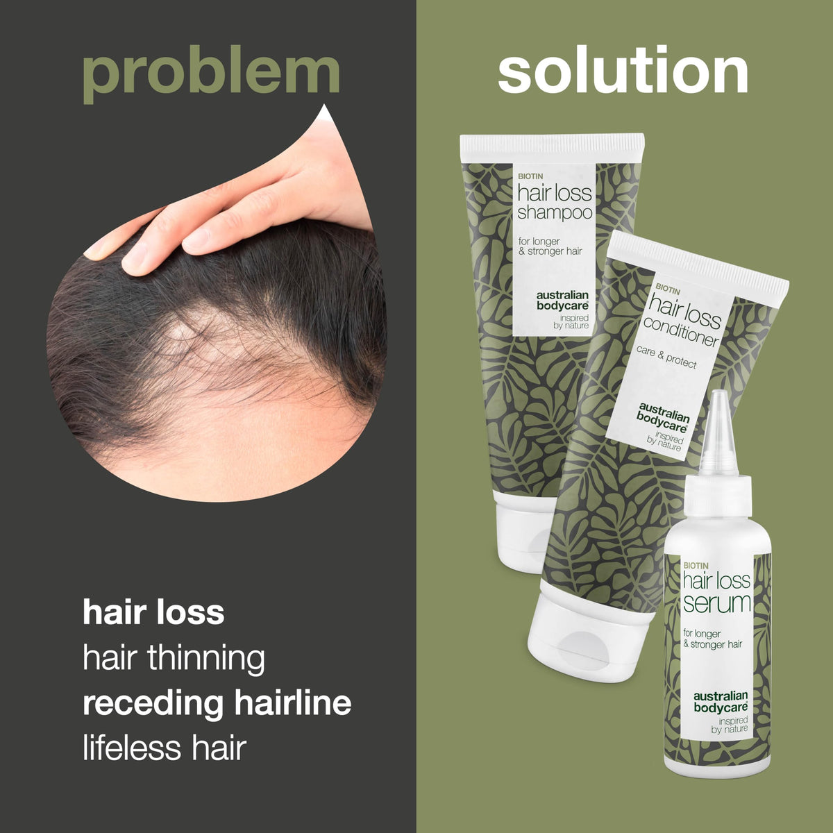 Australian Bodycare The Hair Loss Kit - 3 Products for Women & Men with Hair Loss Problems - Hair Loss Serum 100ml, Shampoo 200ml, Conditioner 200ml with Caffeine