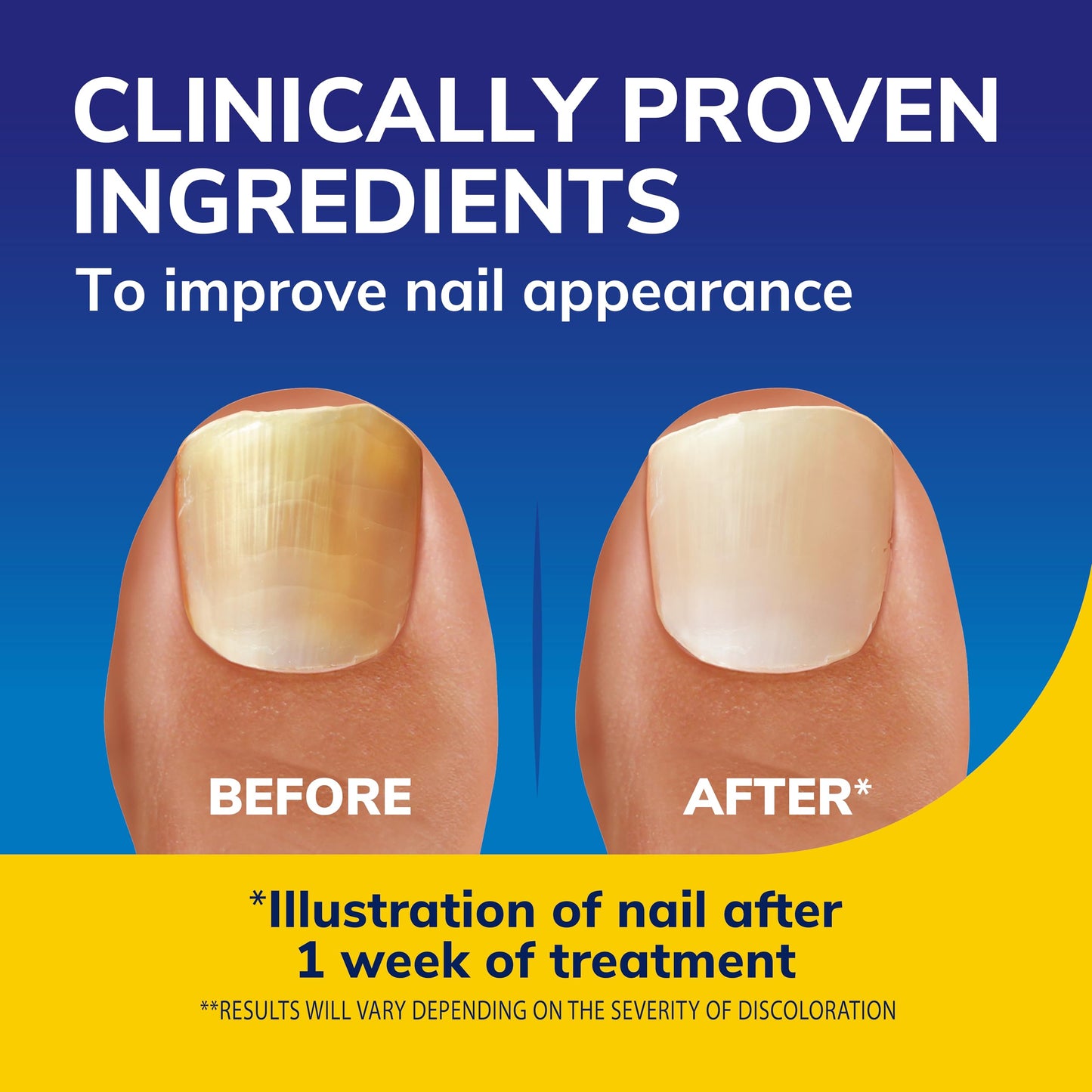 Dr. Scholl's Nail Revitaliser Serum 10ml - Visible Results in Just 2 Days, Triple Action: Brightens, Smooths and Moisturises, Nails and Toenails Damaged by Fungal Nail