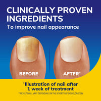 Dr. Scholl's Nail Revitaliser Serum 10ml - Visible Results in Just 2 Days, Triple Action: Brightens, Smooths and Moisturises, Nails and Toenails Damaged by Fungal Nail