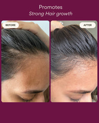 Resèt Invigorating Hair Oil, 100mL - Boosts Hair Growth, Natural Hair Oil With Rosemary, Caffeine Extract, Ashwaganda, Targets Loss & Thinning