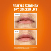 O'Keeffe's Lip Repair Overnight 7g - Intensive Overnight Treatment for Dry, Cracked Lips, Long-Lasting Moisture & Repair