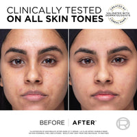 L'Oréal Paris Revitalift Clinical 12% Pure Vitamin C Serum (30ml) & SPF 50+ Invisible Fluid (50ml) Duo for Face, Antioxidant Protection, Brighter Smoother Skin, UV Protection