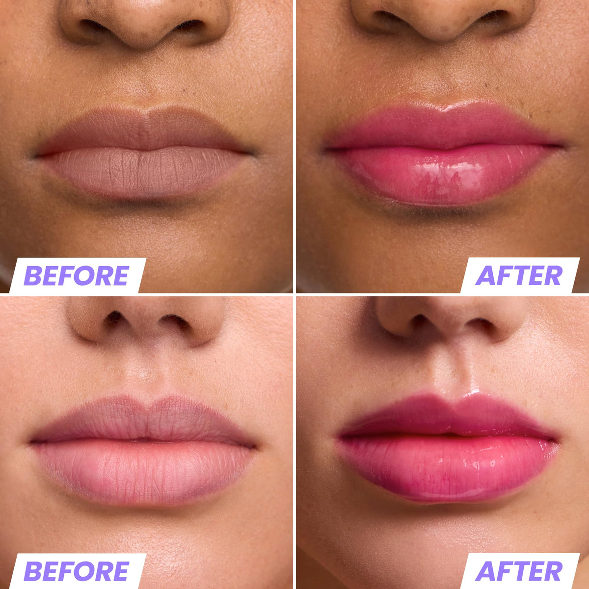 Wonderskin Lip Rehab Serum Oil - Color Changing Lip Oil from Clear to Pink - PH-activated, Non-sticky & Hydrating Tinted Lip Oil for Dry Lips (Kissed)