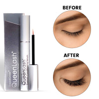 YOUMEE RapidGrow Queenlash and Eyebrow Advanced Regrowth Serum Set, 2 Pieces