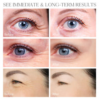 Retinol Stick, Retinol Face Cream, Under Eye Cream Anti Aging, Brightening Balm Reduces Fine Lines and Dark Circles, Visible Results in 3-4 Weeks