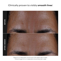 PAULA'S CHOICE Paula's Choice 2% BHA Liquid Face Exfoliant for Blackheads & Pores, 30 ml