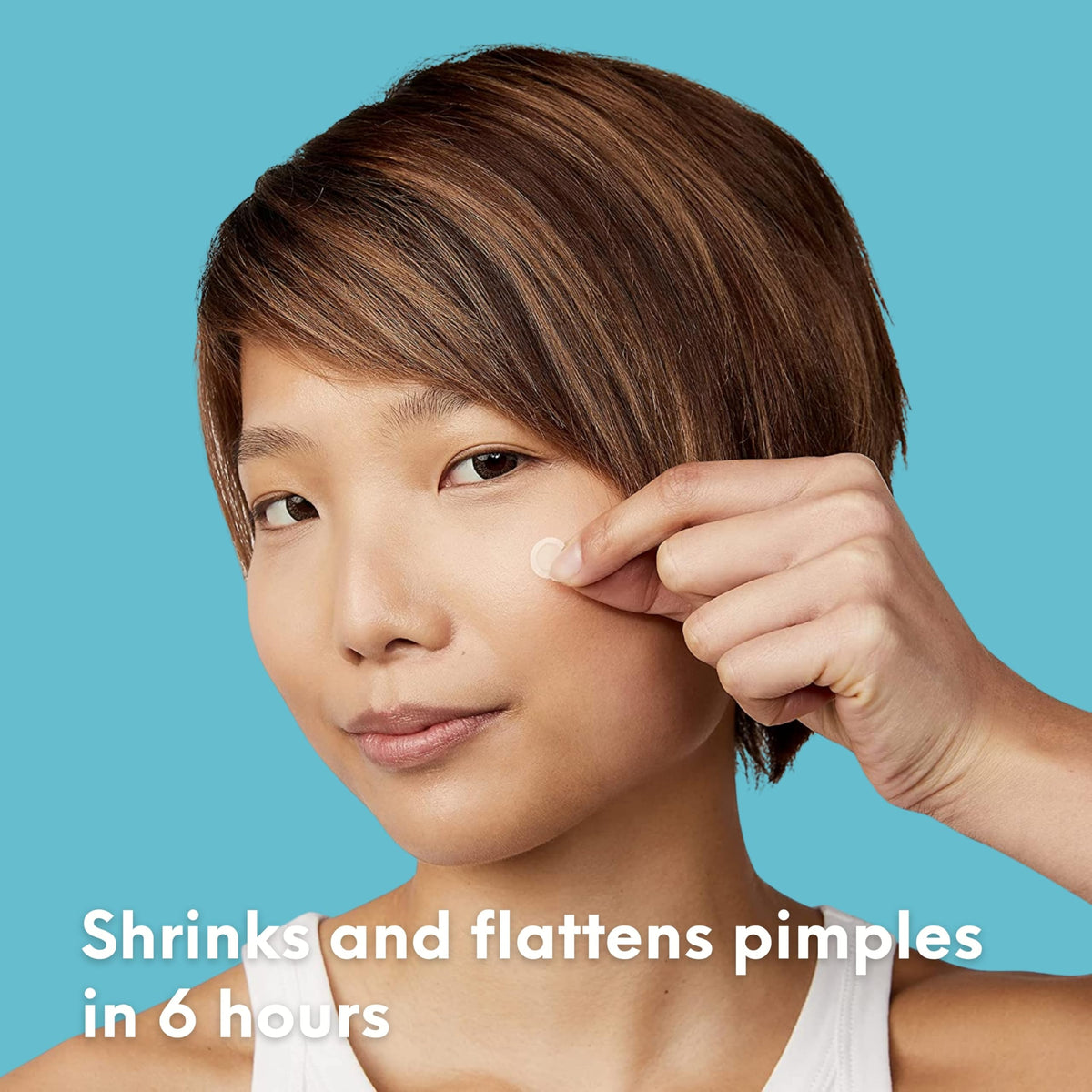 SKIN CHOICE Spot Patches – Breakout Pimple Patches (Pack of 30) Hydrocolloid Patch, Blemish Stickers Spot Dots for Face, Vegan & Cruelty-Free Korean Skincare