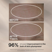 StriVectin Peptide Plump™ Line Filling Serum (30ml) | Alpha 3 Peptides to Hydrate Skin & Plump Skin, Bounce