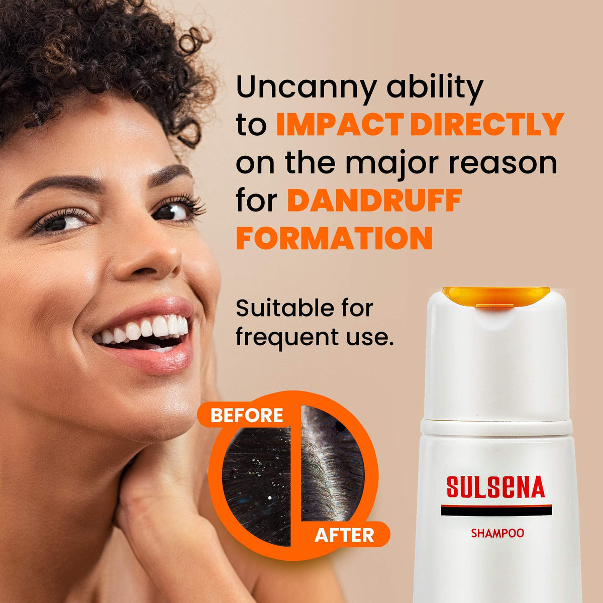 Sulsena SULSENA Anti Dandruff Shampoo for Men and Women - Effective Shampoo for Oily Hair - Anti Dandruff Relief for Itchy Scalp - Nourishing Formula - Best Anti Dandruff Shampoo for Men and Women