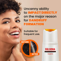 Sulsena SULSENA Anti Dandruff Shampoo for Men and Women - Effective Shampoo for Oily Hair - Anti Dandruff Relief for Itchy Scalp - Nourishing Formula - Best Anti Dandruff Shampoo for Men and Women