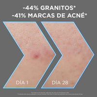 Pure Active AHA + BHA + Carbón Sérum Anti-Impregnancy 30 ml