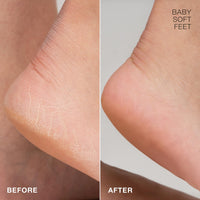 STARSKIN Magic Hour 1x50g, Exfoliating Foot Mask Sock with Lactic and Glycolic Acid, Gently Removes Calluses and Dead Skin for Effective Peeling, K Beauty Skincare