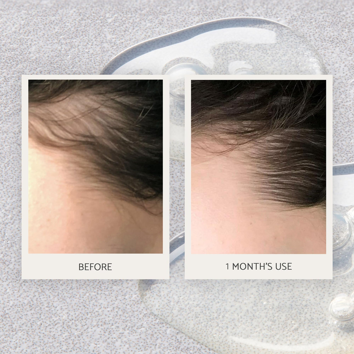Percy & Reed Hair & Scalp Regime, Strengthening Shampoo, Conditioner and Scalp Concentrate 50ml Each, Perfect Bundle for Dry Damaged Fragile Strands, Includes Hair Growth Serum, Reduces Breakage
