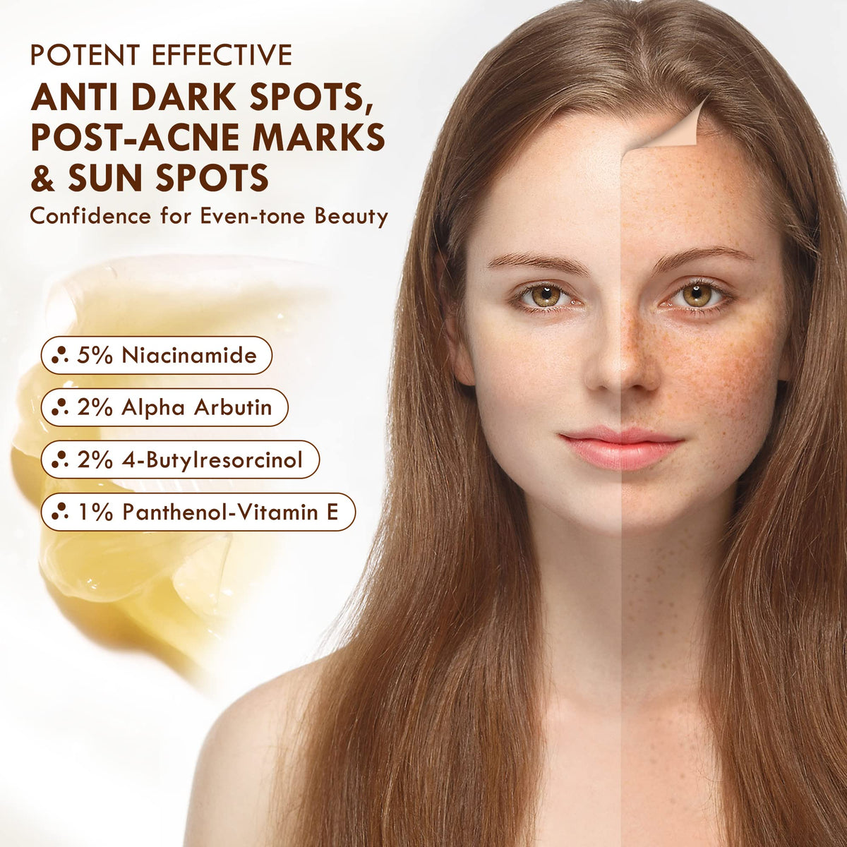 cosmpro Dark Spot Remover for Face and Body, Age Spot Remover for Face, Dark Spot Corrector Freckle Remover, Sunspots and Melasma with 2% Alpha Arbutin, 5% Niacinamide, 50 ml
