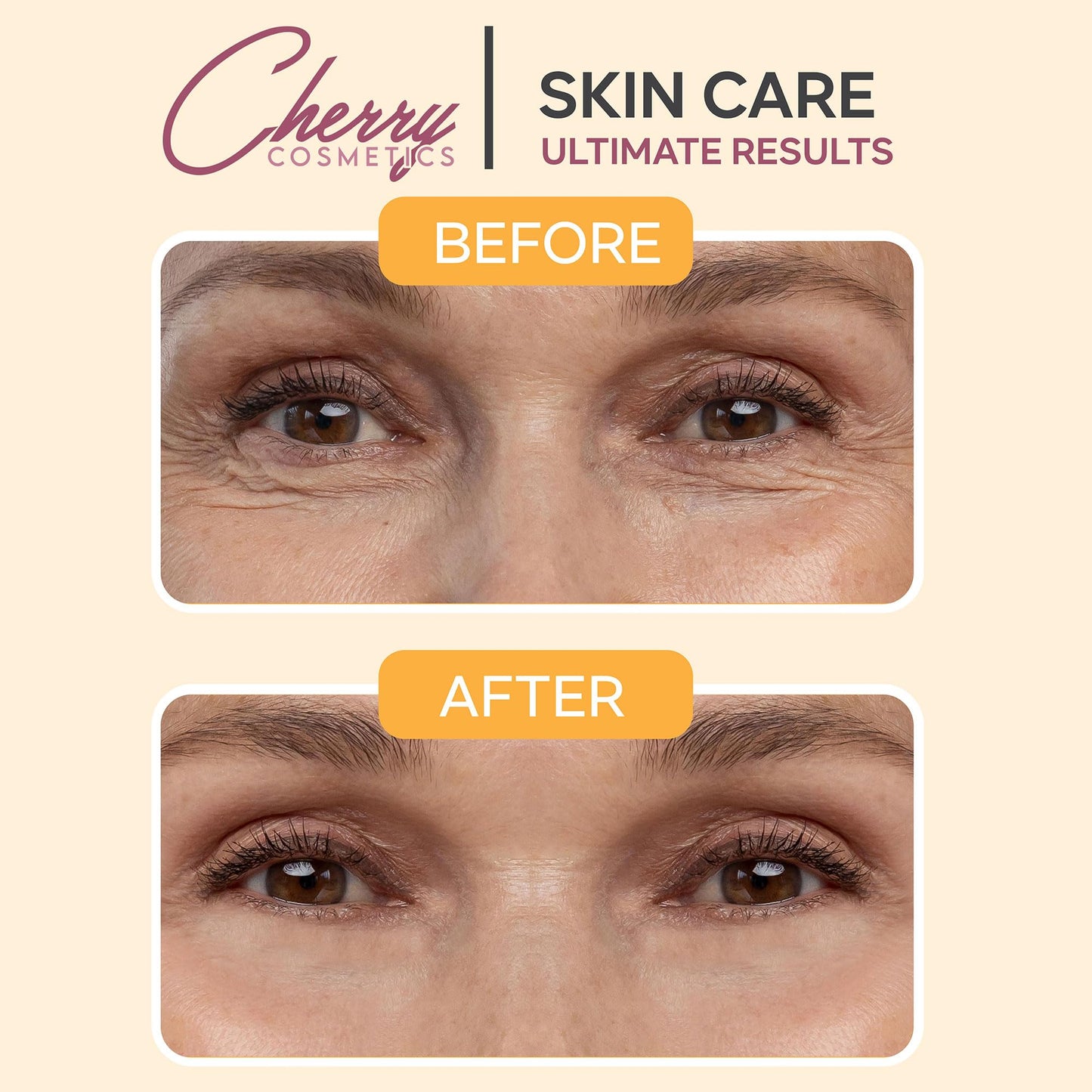 Cherry Cos Retinol Serum with Vitamin A and Wrinkle Away Instant Effect. Skin Renewing Anti-Ageing Face Serum. Age Spots and Milia Remover Skin Care Serum for Your Skincare.