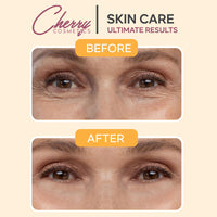 Cherry Cos Retinol Serum with Vitamin A and Wrinkle Away Instant Effect. Skin Renewing Anti-Ageing Face Serum. Age Spots and Milia Remover Skin Care Serum for Your Skincare.