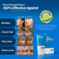 Retinol Cream | Anti aging face cream with Retinol, Antioxidant Vitamin E and Glycerin | Reduces wrinkles, brightens skin and improves elasticity | Fragrance free for sensative skin