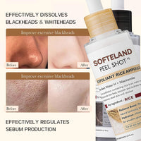 TMYIOYC Peel Shot Glow Rice Ampoule Duo, Face Exfoliator Rice Toner, Gentle Exfoliating Face Scrub for Blackhead Remover Dead Skin, Refines Pores, Radiant Complexion, AHA + BHA, Korean Skincare 80ml*2