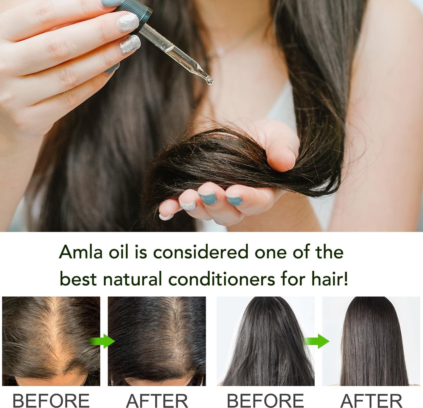 WeiWeiLa Amla Hair Oil, Amla Oil for Hair Growth, 100% Natural Indian Amla Hair Oil for Strong, Long & Thick Hair, Nourishes Scalp, Promotes Hair Growth, Controls Hair Fall, 60ML