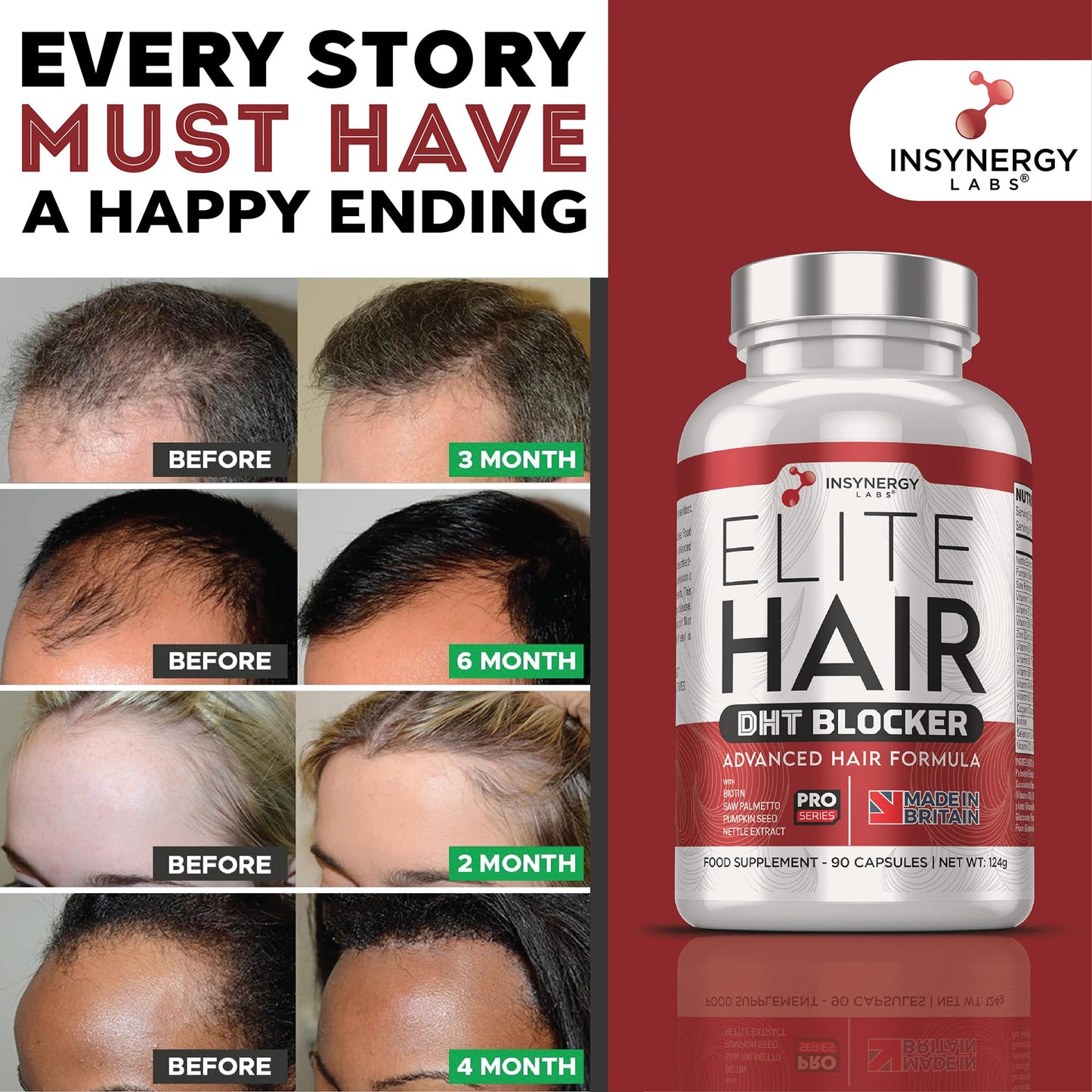 DHT Blocker Elite Hair, Hair Growth Supplement | #1 Advanced Hair Supplements for Women & Men | DHT Blocker Tablets Hair Growth Vitamins | 90 Capsules 16 Ingredients in 1