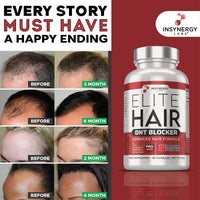 DHT Blocker Elite Hair, Hair Growth Supplement | #1 Advanced Hair Supplements for Women & Men | DHT Blocker Tablets Hair Growth Vitamins | 90 Capsules 16 Ingredients in 1