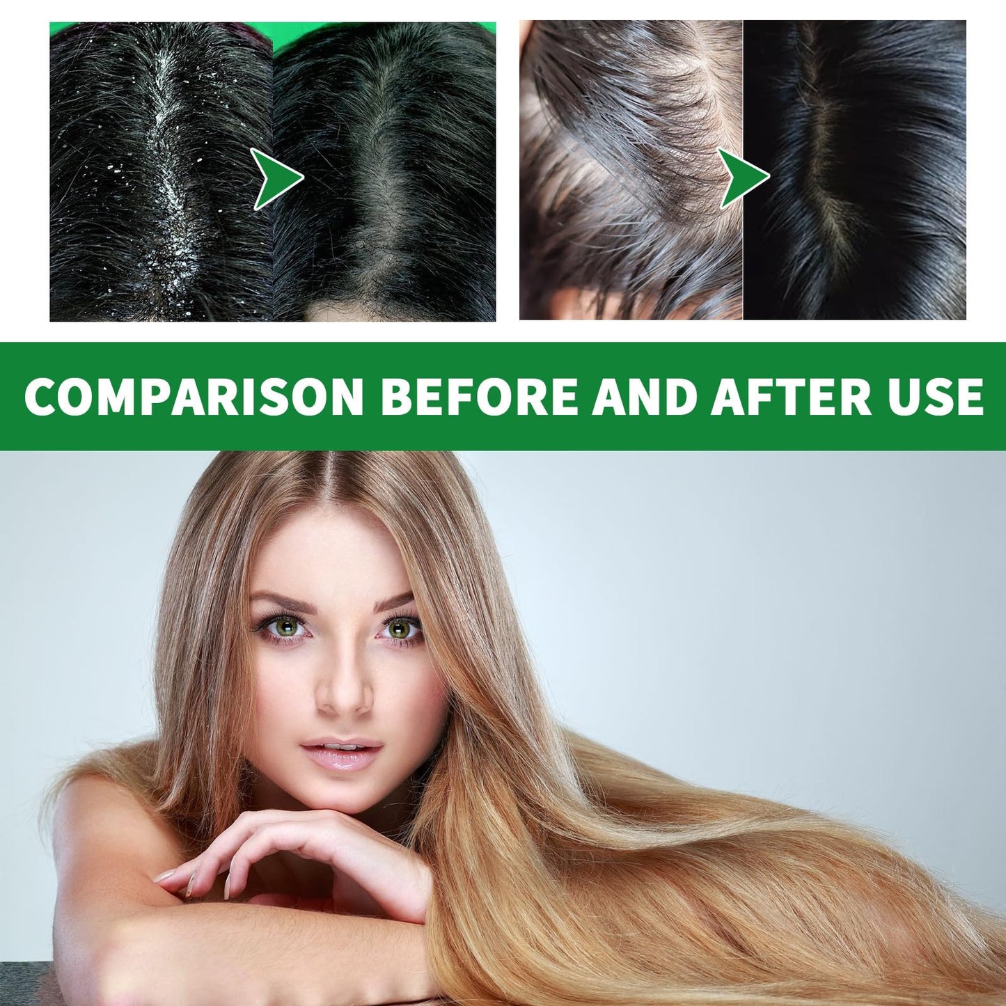 Alvies® Sulfur Deep Cleaning anti-dandruff Shampoo Size: 7.5oz