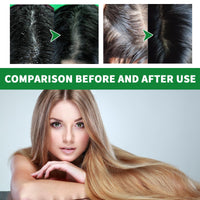 Alvies® Sulfur Deep Cleaning anti-dandruff Shampoo Size: 7.5oz