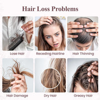 Kings 100% Natural Rosemary Oil for Hair Growth with Biotin - Promotes Hair Growth & Prevents Hair Loss, Organic Rosemary Hair Oil to Treat Dry Damaged Hair for Men & Women | 100 ml