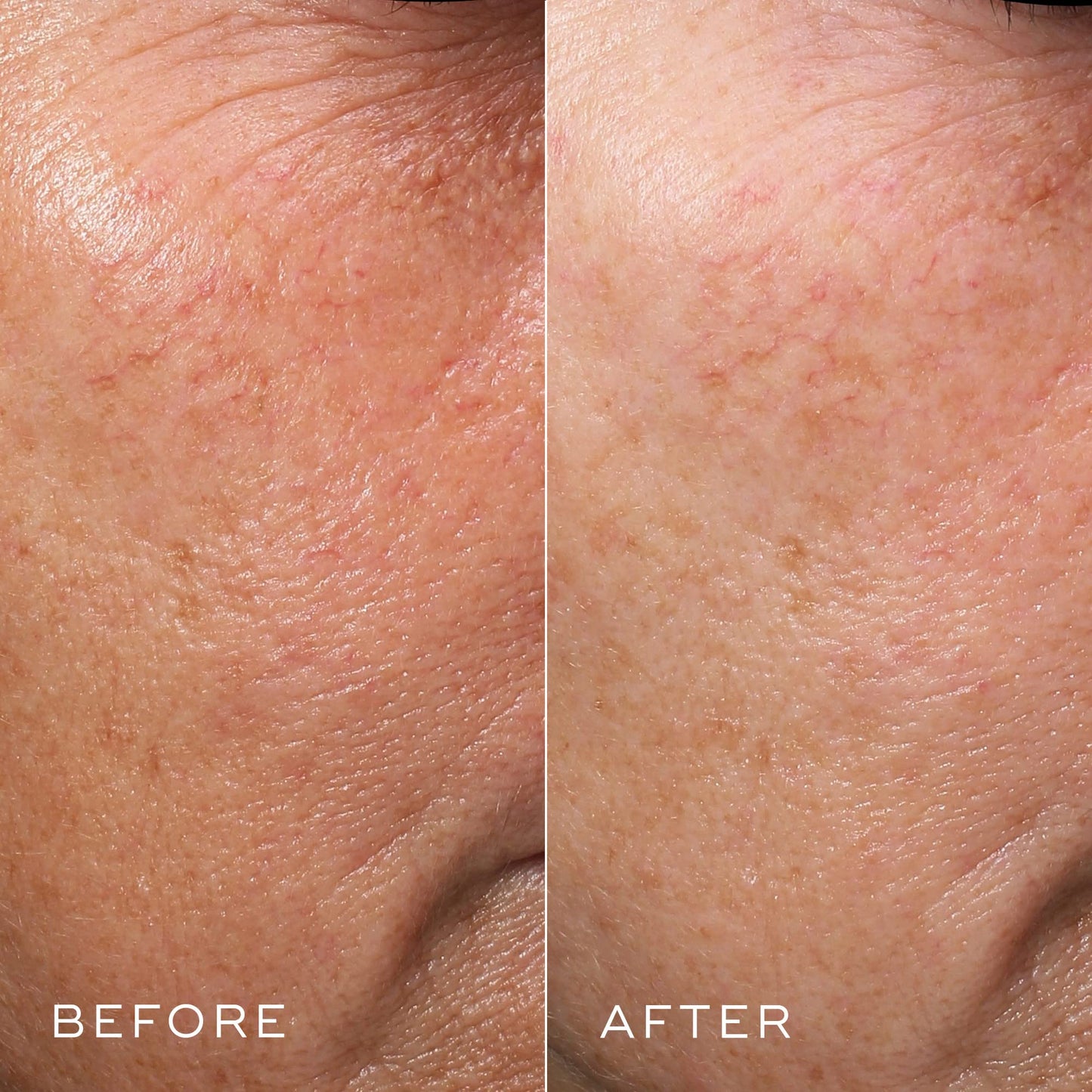 Medik8 Crystal Retinal 3 - Age-Defying Encapsulated Retinal Face Serum - Smoothing, Firming, Brightening & Decongesting - Improves Wrinkles & Hyperpigmentation - All Skin Types