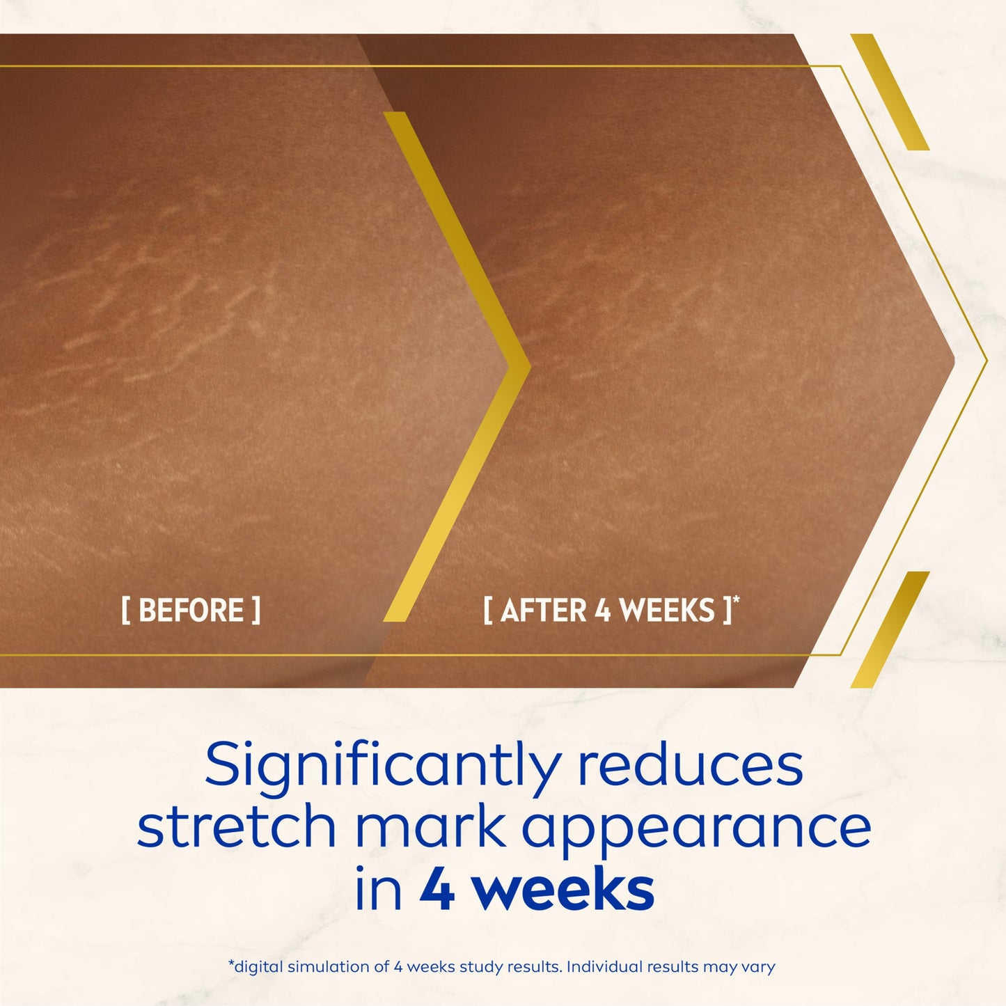NIVEA Luminous 630 Body Oil Serum Anti Stretch Marks (100ml), Skincare Serum with Luminous 630 Visibly Reduces Stretch Marks in 2 weeks, Starts Working From Day 1