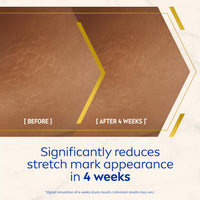NIVEA Luminous 630 Body Oil Serum Anti Stretch Marks (100ml), Skincare Serum with Luminous 630 Visibly Reduces Stretch Marks in 2 weeks, Starts Working From Day 1