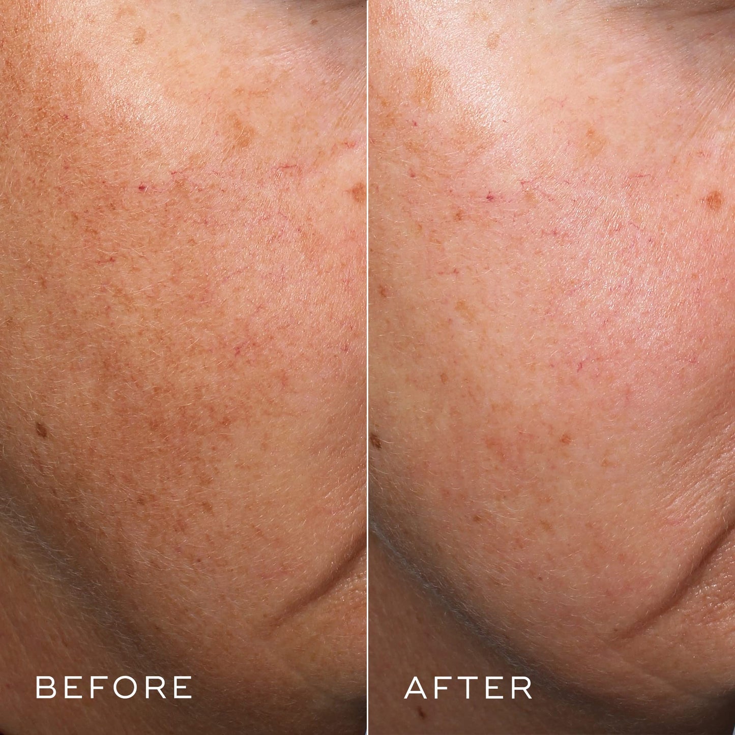 Medik8 Crystal Retinal 3 - Age-Defying Encapsulated Retinal Face Serum - Smoothing, Firming, Brightening & Decongesting - Improves Wrinkles & Hyperpigmentation - All Skin Types