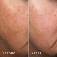 Medik8 Crystal Retinal 3 - Age-Defying Encapsulated Retinal Face Serum - Smoothing, Firming, Brightening & Decongesting - Improves Wrinkles & Hyperpigmentation - All Skin Types