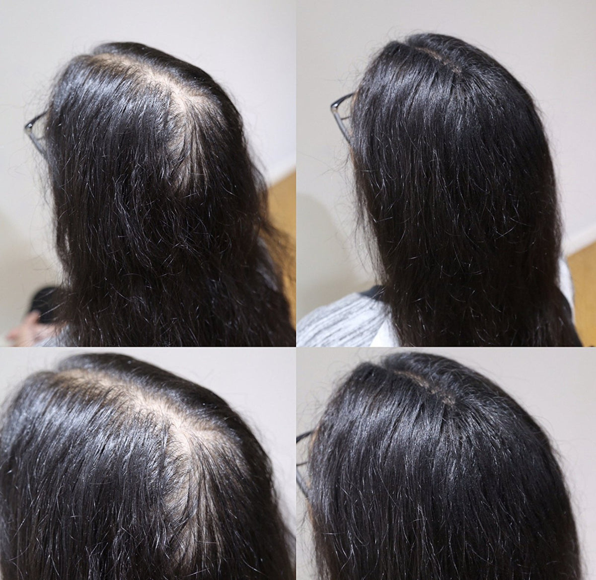 LDN Professional Hair Building Fibres for Hair Loss and Thin Hair, No.1 for Instantly Thickening Hair Naturally, 20g hair fiber bottle (Black)