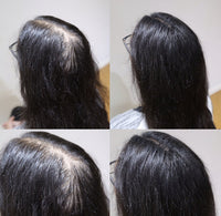 LDN Professional Hair Building Fibres for Hair Loss and Thin Hair, No.1 for Instantly Thickening Hair Naturally, 20g hair fiber bottle (Black)