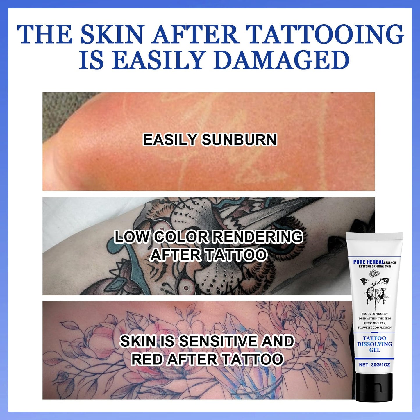 Tattoo Cleaning Cream, Fast and Effective—TATTOO Cleaning Cream, Removes Skin Pigmentation, Painless Tattoo Removal, Fast Absorption, No Scars (1PC)