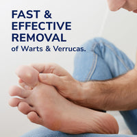 Dr. Scholl's Wart and Verruca Removal Plasters, Pack of 21, Fast and Effective Verruca Treatment and Wart Remover, Immediate Pain Relief, Washproof Plasters