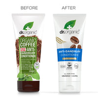 Dr. Organic Dr Organic Coffee Anti-Dandruff Conditioner, Healthy Scalp, Mens, Womens, Natural, Vegan, Cruelty-Free, Paraben & SLS-Free, Recycled & Recyclable, Organic, 200ml, Packaging may vary