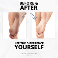 Dermavitamins Advanced Foot Mask Bag - Repairs Dry Feet (Peeling)