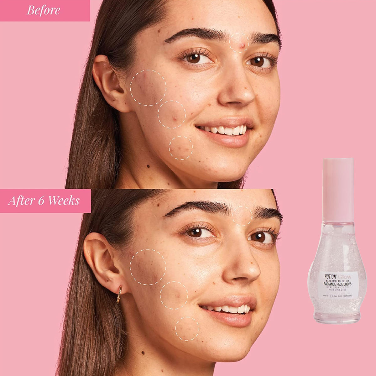Katsy Style Watermelon Elixir Radiance Face Drops | Hydrating Serum with Hyaluronic Acid & Niacinamide | Brightening & Plumping Face Serum 50ml