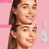 Katsy Style Watermelon Elixir Radiance Face Drops | Hydrating Serum with Hyaluronic Acid & Niacinamide | Brightening & Plumping Face Serum 50ml