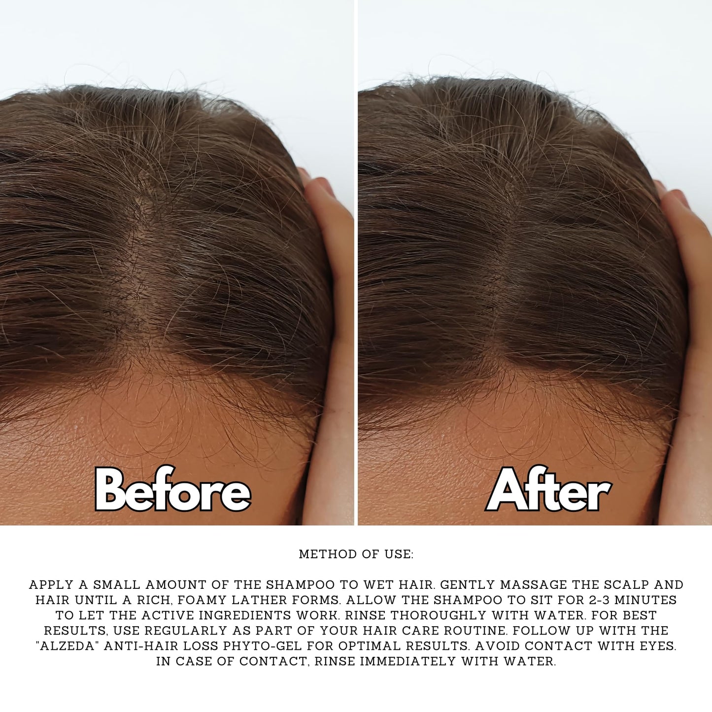 ALZEDA Anti Hair Loss Shampoo 200 ml with Biotin, Rosemary, Vitamin C, B12, B Complex, Mint | Anti Hair Loss | Hair Growth | for Men and Women | Hair Growth | Hair Loss