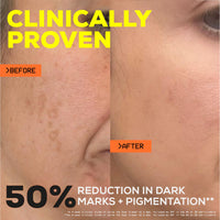 Glow Hub The Scar Slayer Facial Serum with Vitamin C for Anti-Pigmentation and Blemish Prone Skin 30ml