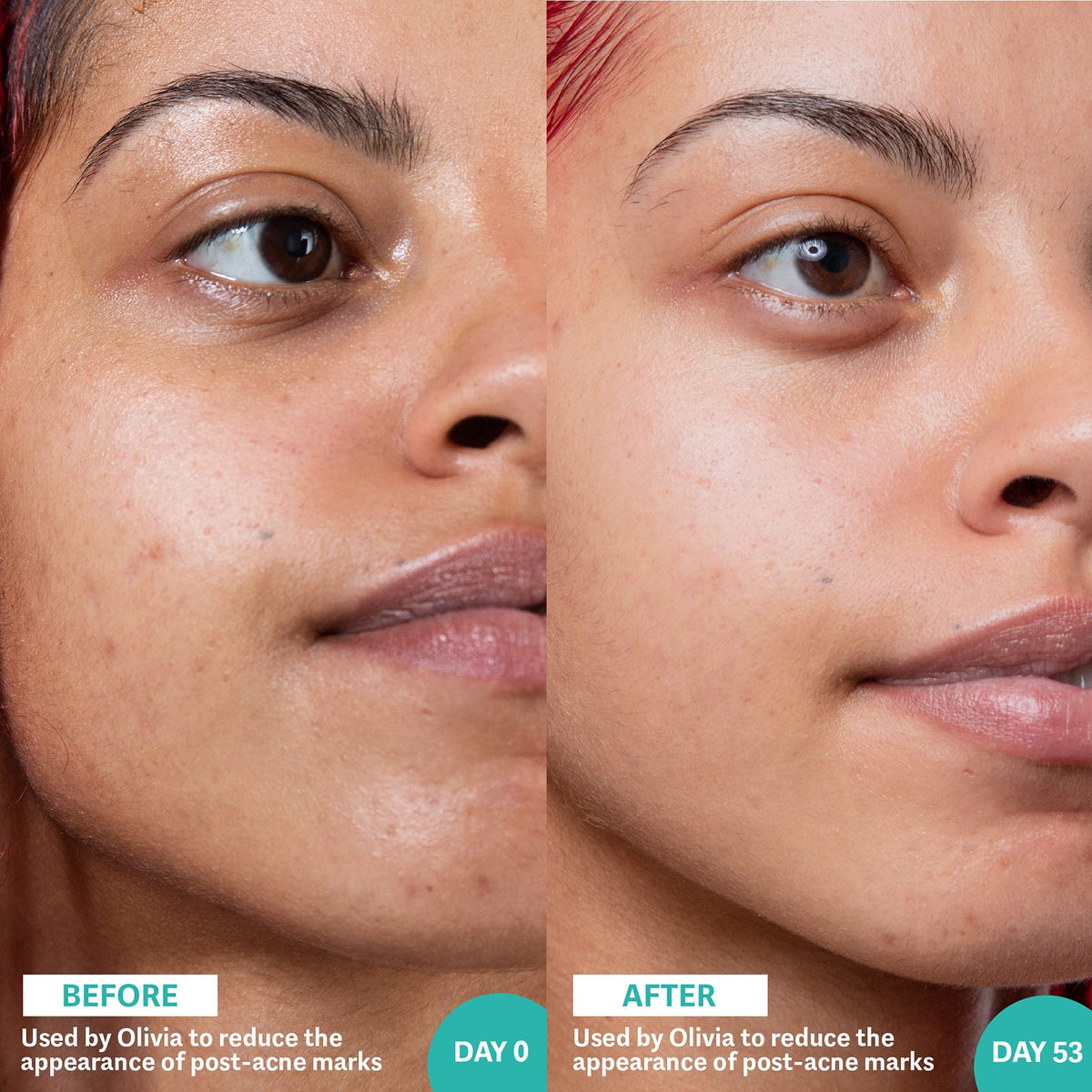 Selfless by Hyram Retinol and Rainbow Algae Repair Serum to Gently Target Post-Breakout Marks and Hyperpigmentation 30ml, White