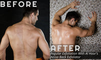 Al Hoor AL HOOR Moroccan Kessa Back Scrubber for Shower - Long Strap, Viscose Back Scrubber, Acne Treatment, Ingrown Hair Treatment, Back Exfoliator For Glowing & Smooth Skin, Dry Skin & Dead Skin Remover