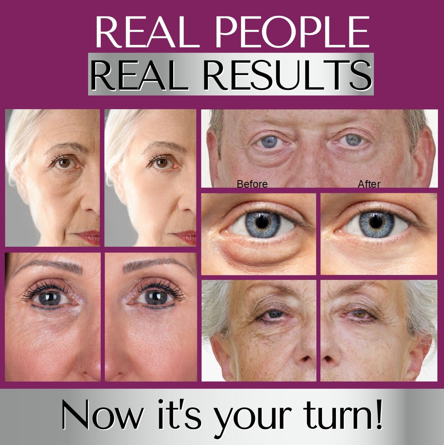 Dermaworks NEW Immaculift Instant Eye Tightener - Eye Cream for Dark Circles and Puffy Eyes –Under Eye Bags Treatment – Eye Lift Cream – Eye Tightening Cream Instant – Eye Bags Remover Men & Women by DERMAWORKS