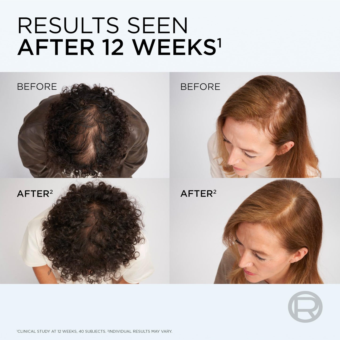 L'Oreal Paris Elvive Growth Booster Conditioner, 150ml